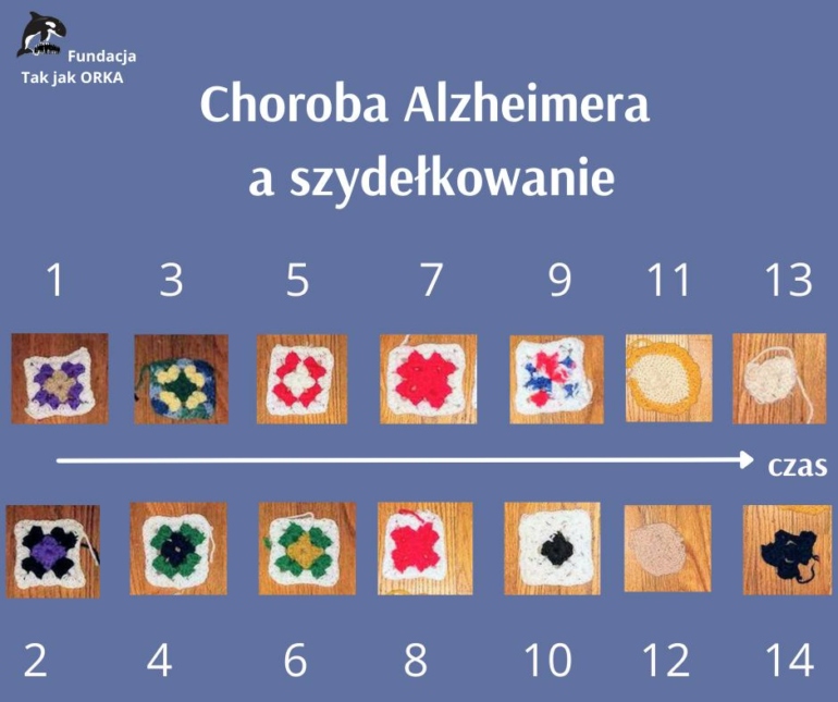 Szydełkowanie pokazuje postęp choroby Alzheimera